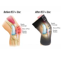 OS1st KS7+ Adjustable Performance Knee Sleeve 12 OS1st KS7+ Adjustable Performance Knee Sleeve -Pickleball Promotion Store OSF118 4 27552.1663784835